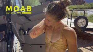 Emily got scraped up from a mountain bike crash in Moab
